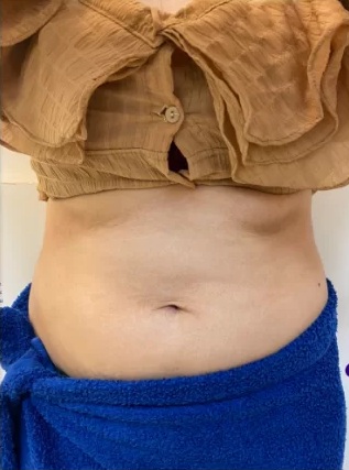 Before Inshape